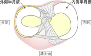 膝裏が痛むのですが どんな病気が考えられますか 札幌ひざ関節症クリニック 公式